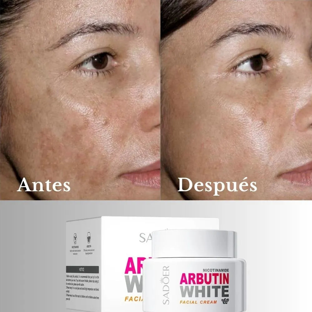 SADÔER ARBUTIN WHITE - ¡El secreto oriental de una piel más clara, joven y radiante!