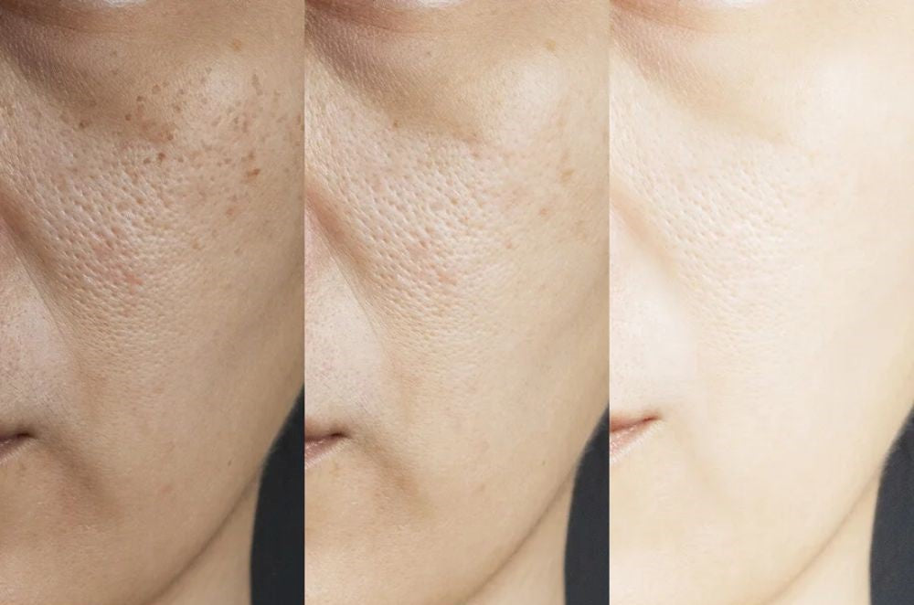 SADÔER ARBUTIN WHITE - ¡El secreto oriental de una piel más clara, joven y radiante!