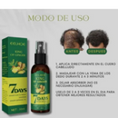 GingerPower: El elixir de la restauración capilar